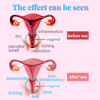 Productos de cuidado vaginal para la salud de la mujer Función de estrechamiento de la vagina 2 años de vida útil